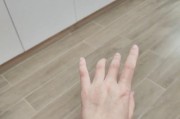 手机摄像头冒紫光是什么意思？是否需要维修？