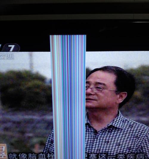 电视机竖线条纹的维修方法（解决电视机竖线问题的有效措施）