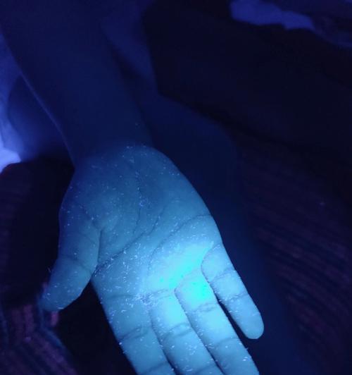 手机摄像头冒紫光是什么意思？是否需要维修？